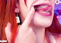 SFW Braces Elastics Close-Up